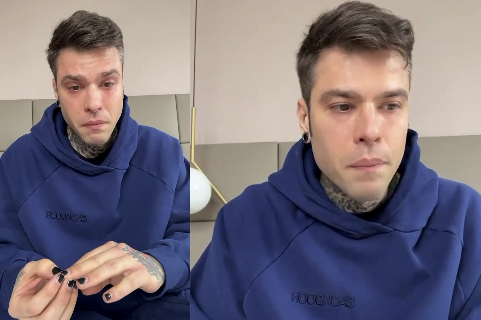 Fedez: Operato D'urgenza Al San Raffaele Di Milano - Guida TV Notizie